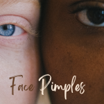 Pimples